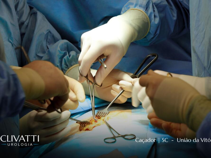 Imagem ilustra uma cirurgia Urológica da Clínica Clivatti de Urologia em Caçador e União da Vitória